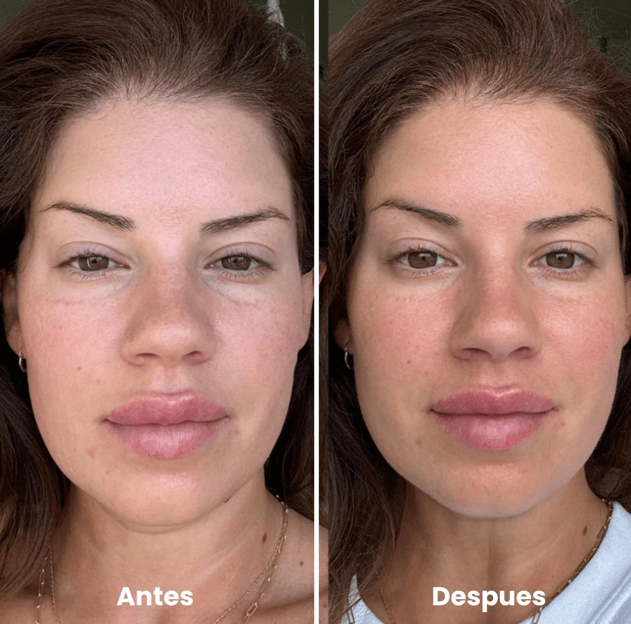 Verona™ Rodillo de Hielo Facial