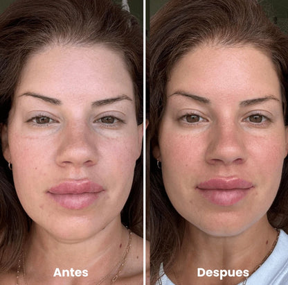 Verona™ Rodillo de Hielo Facial